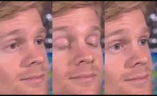 A man with a beard blinking and turning his head in surprise, shown in several frames